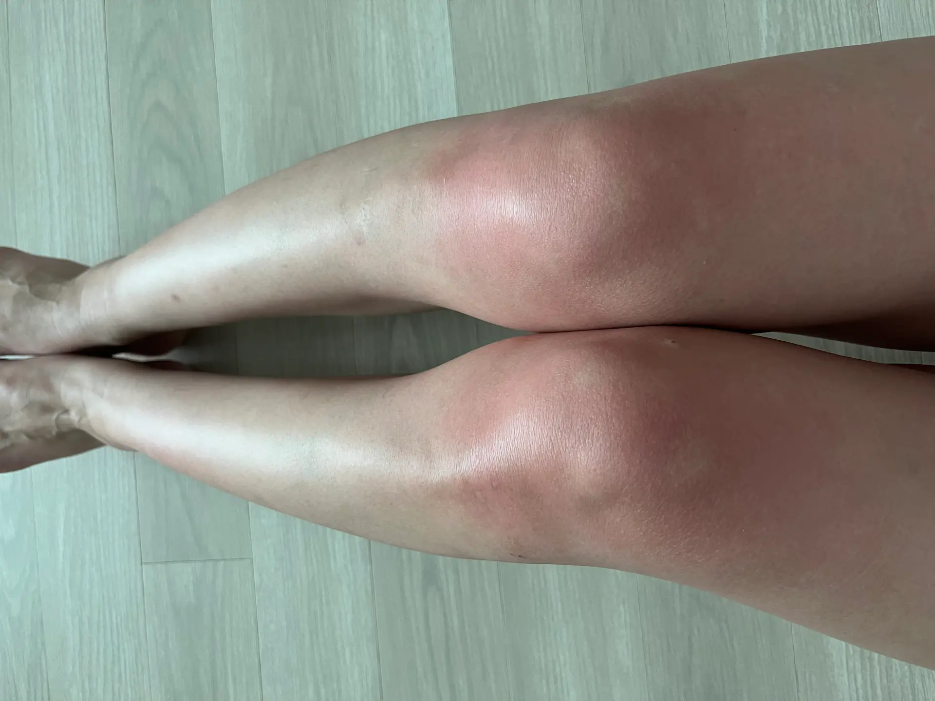 [2배 강력해진 리뉴얼]바인허브 버닝온의 리뷰 이미지